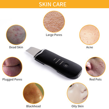 Ultrasonic Face Skin Scrubber Facial Cleaner Peeling Vibration Αφαίρεση μαύρων στιγμάτων Απολέπιση Pore Cleaner Συσκευή περιποίησης δέρματος