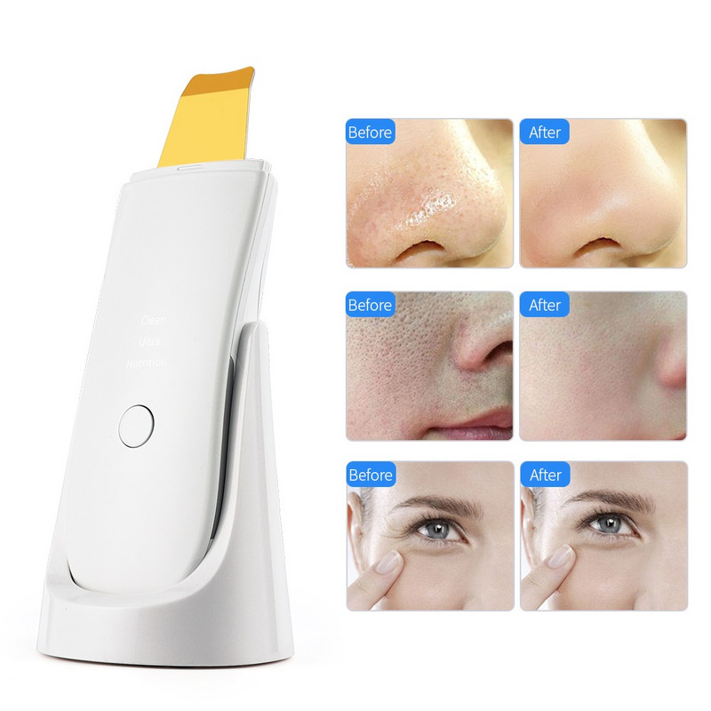 Vízálló ultrahangos arcbőrradír Peeling mély arctisztító mitesszer eltávolítása arcpórustisztító bőr lifting gép