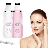 LCD képernyő Ultrahangos bőrradír mély arcpórustisztító mitesszer elhalt bőr tisztító peeling lapát arc lifting szépség