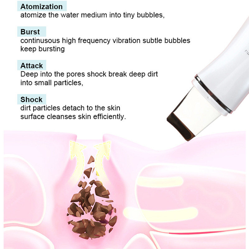 Ultrahangos bőrradír peeling lapát Ion akne mitesszer eltávolító elhalt bőr mélytisztító gép arc lifting arcmasszírozó