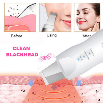 Νέο υπερηχητικό Skin Scrubber Vibration Spatula Face Remover Shovel Clean Cavitation Peeling Σετ Μακιγιάζ Περιποίησης Δέρματος Προσώπου