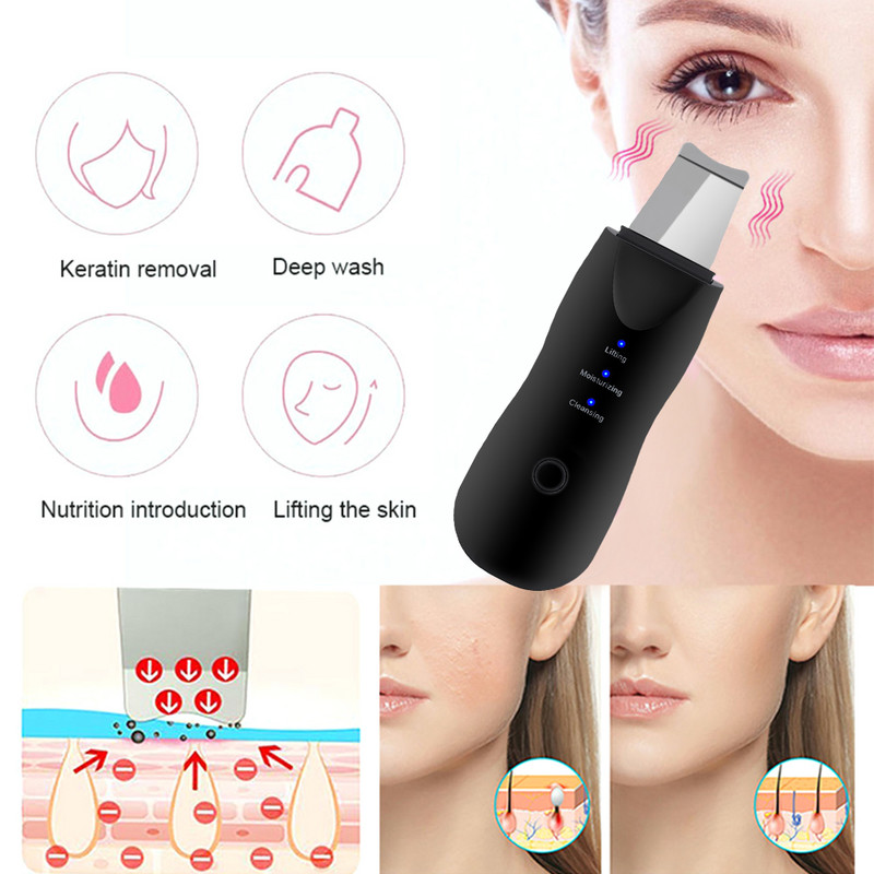 Új ultrahangos bőrradír vibrációs arc spatula mitesszer eltávolító lapát Clean kavitációs peeling arcbőr ápoló sminkkészlet
