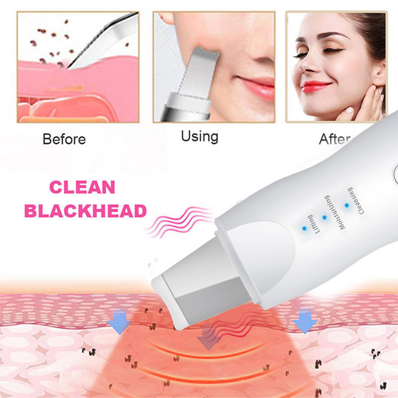 Új ultrahangos bőrradír vibrációs arc spatula mitesszer eltávolító lapát Clean kavitációs peeling arcbőr ápoló sminkkészlet