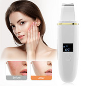 Ultrahangos bőrradír nagyfrekvenciás mitesszer eltávolítása arcradír peeling lapát Clean Facial Lifting Machine Dropship