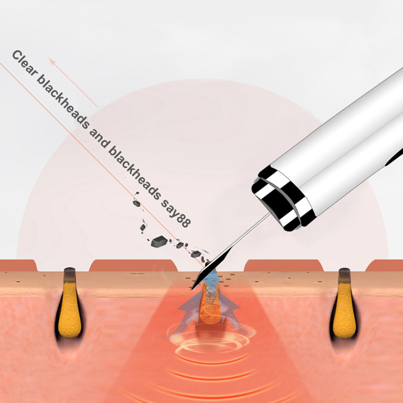 Ultrahangos Bőrradír Vibrációs Arc Spatula Mitesszer eltávolító Lapát Tiszta Kavitációs Peeling Arc Lifting Bőrápolás