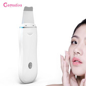 Ultragarsinis odos šveitiklis veido valiklis joninis spuogų inkštirų valiklis šveitimo kastuvu valiklis veido masažuoklis veido pakėlimo aparatas