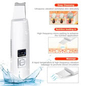 Ultrahangos bőrradír tisztító arctisztító akne eltávolítása arcmasszírozó ultrahangos peeling Clean Tone lifting