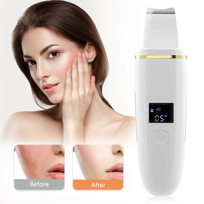 Ultrahangos bőrradír mély arctisztító gép peeling lapát arc pórustisztító arcbőrradír lifting gép