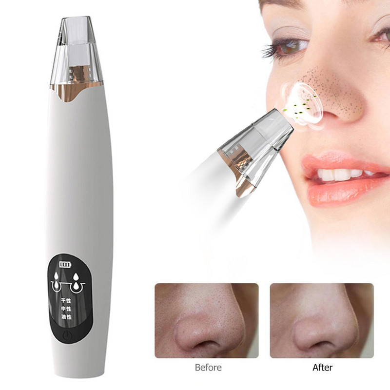 Skin Ultrahangos súroló mély bőrpórustisztító gép peeling lapát Mitesszer eltávolító Arc Skin Lift Sonic Cleansing Importer