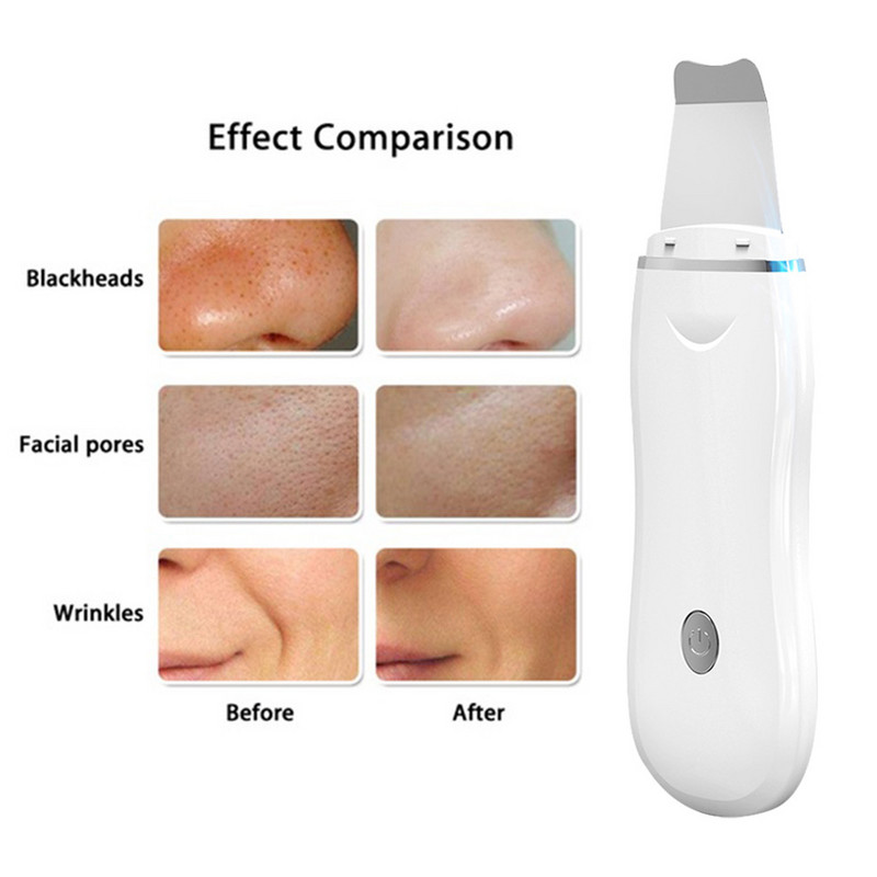 Új ultrahangos bőrradír Vibrációs arc spatula mitesszer eltávolító lapát Clean Cavitatie peeling arc lifting smink eszközök