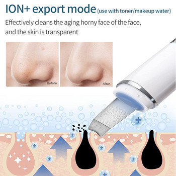 Ultrasonic Skin Scrubber Cleaner Pore Cleaner Facial Ion Deep Cleaning Blackhead Dead Skin Remover Beauty Tool