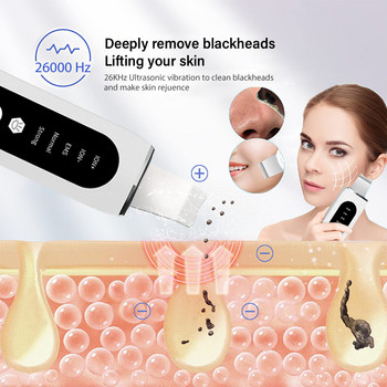 Ultrasonic Skin Scrubber Facial Shovel Deep Cleaning Remover Blackhead Face Cleanser Pore Dead Peeling Cavitation Ion EMS Lift