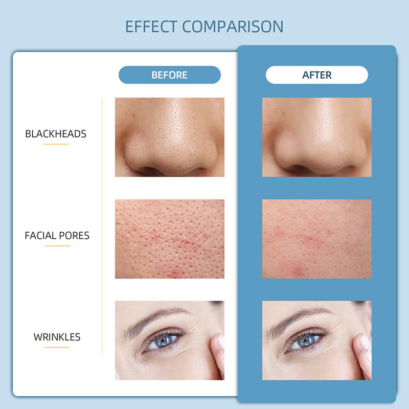 Ultrahangos ionos tisztító eszköz masszázs bőrradír peeling lapát arc pórustisztító arcbőrradír lifting gép