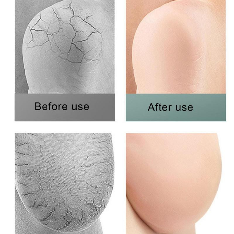 2tk 3D kontsa niisutavad sokid geel varbata jalahooldus parandussokid ennetavad pragusid ja eemaldavad nahapõletikke Kodused jalgade hooldusvahendid