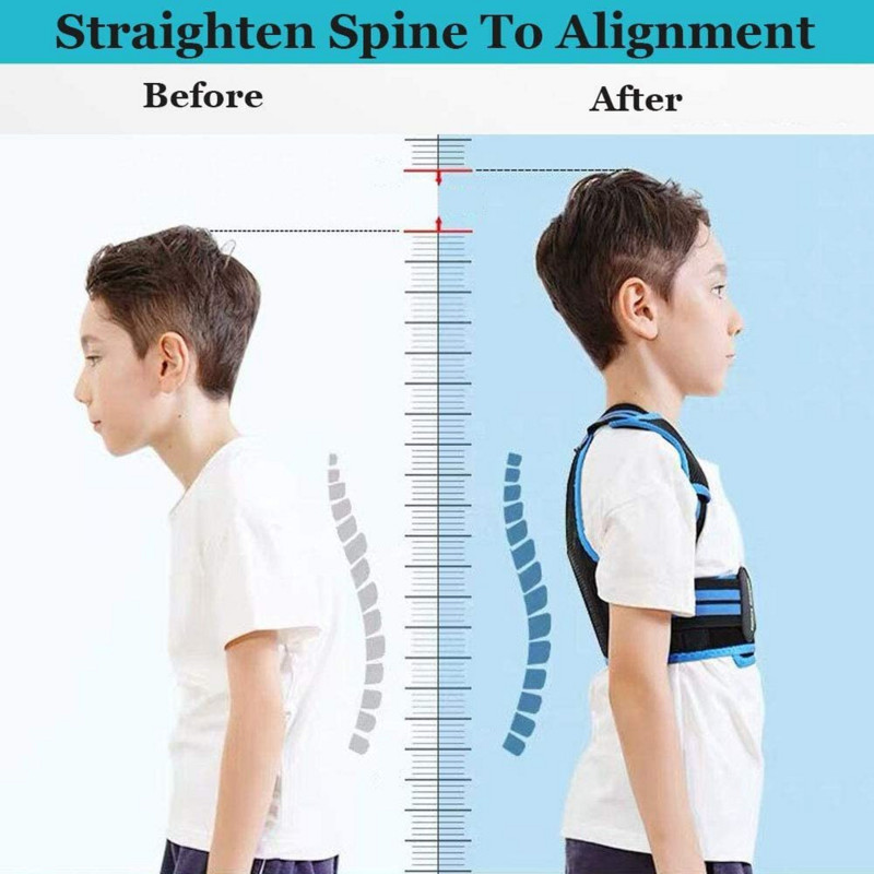 Детски коректор на стойката Подкрепа за гръбначния стълб за подобряване на прегърбването, предотвратяване на гърба, облекчаване на болки в гърба Тийнейджъри Момчета Момичета