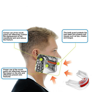 WorthWhile Sport Mouth Guard EVA Προστατευτικό Δοντιών Παιδιά Ενήλικες Προστασία δοντιών στοματοφυλάκιο Μπάσκετ Ράγκμπι Μποξ Καράτε