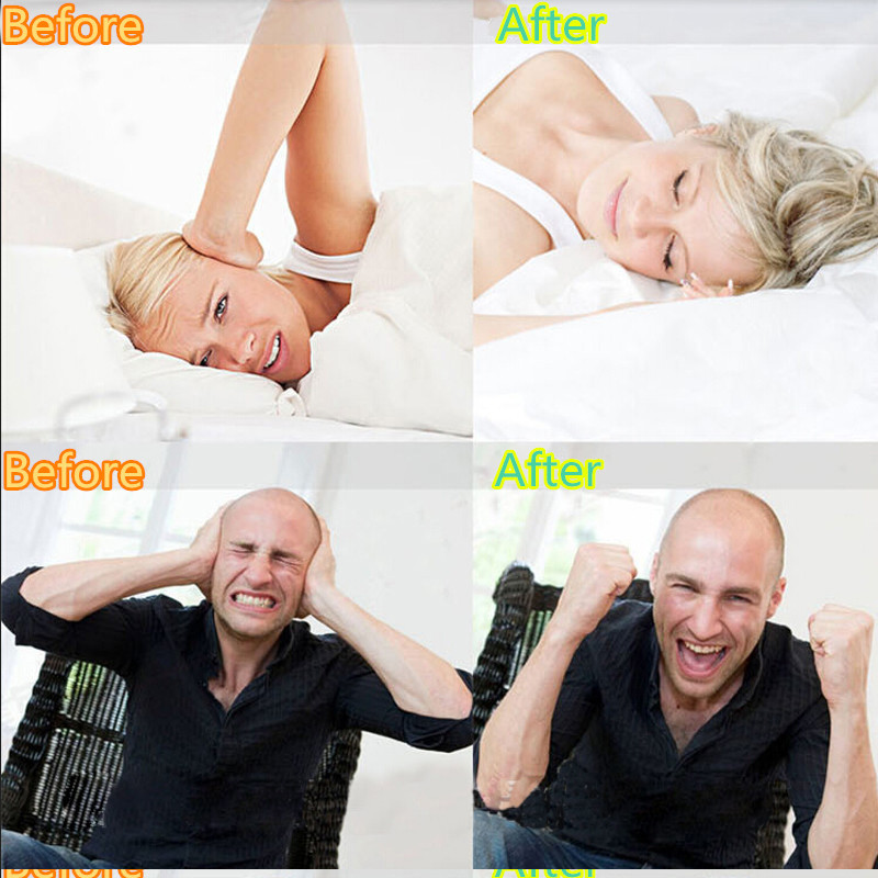 Skaidrus bruksizmo dantų šlifavimo apsauginis miegas burnos apsaugos įtvaras suspaudimo apsauginis įrankis su dėžute lauko sporto saugos įrankiais