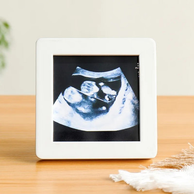 Četru dimensiju krāsu ultraskaņas attēls ar mazuļa masīvkoka biroja darbvirsmas mazu fotoattēlu rāmi, bērna augšanas rekorda foto rāmis