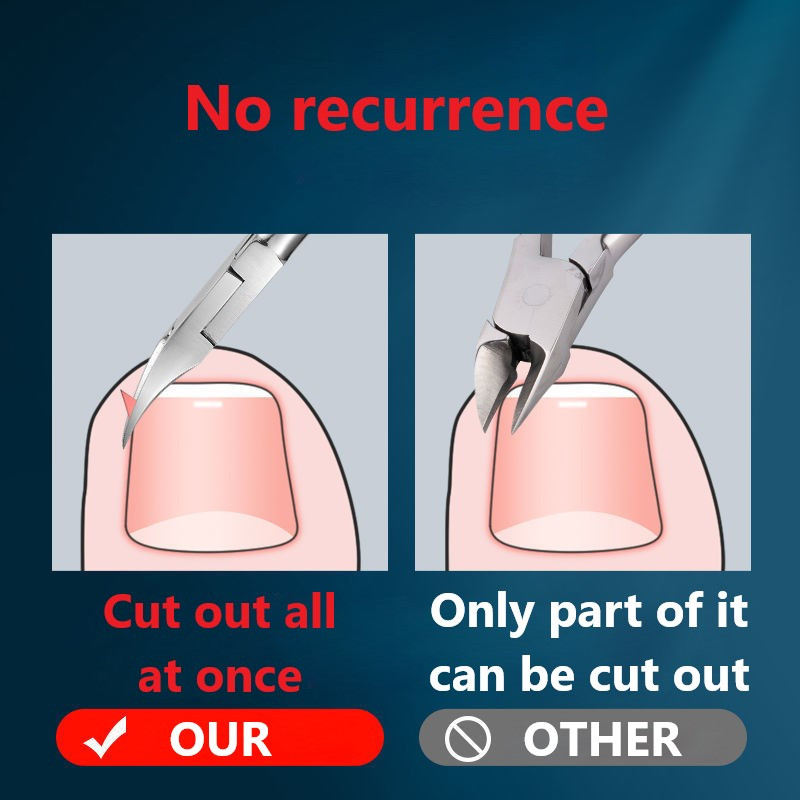 1 τμχ Επαγγελματικό ψαλίδι για την επιδερμίδα των νυχιών Μαύρα δάχτυλα με τα δάχτυλα με τα δάχτυλα του ποδιού Πένσα για το κούρεμα του νυχοκόπτη Nipper Εργαλεία μανικιούρ πεντικιούρ