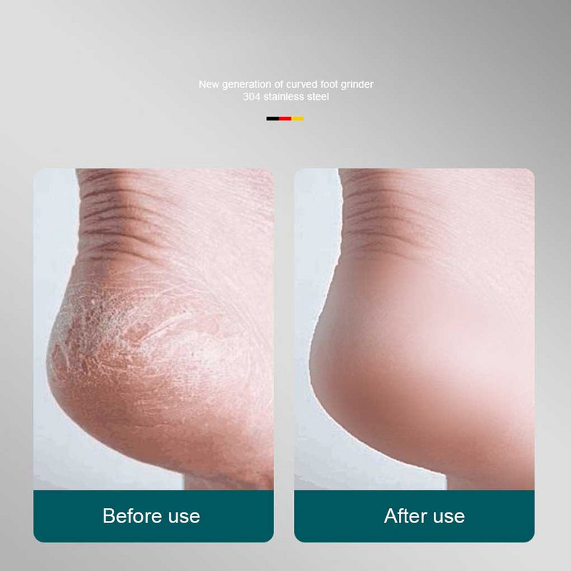 Foot Rasp File Professionaalne lihtne isikliku hoolduse pediküüri tarvik roostevabast terasest nahapõletiku eemaldaja tarvikud rohelised