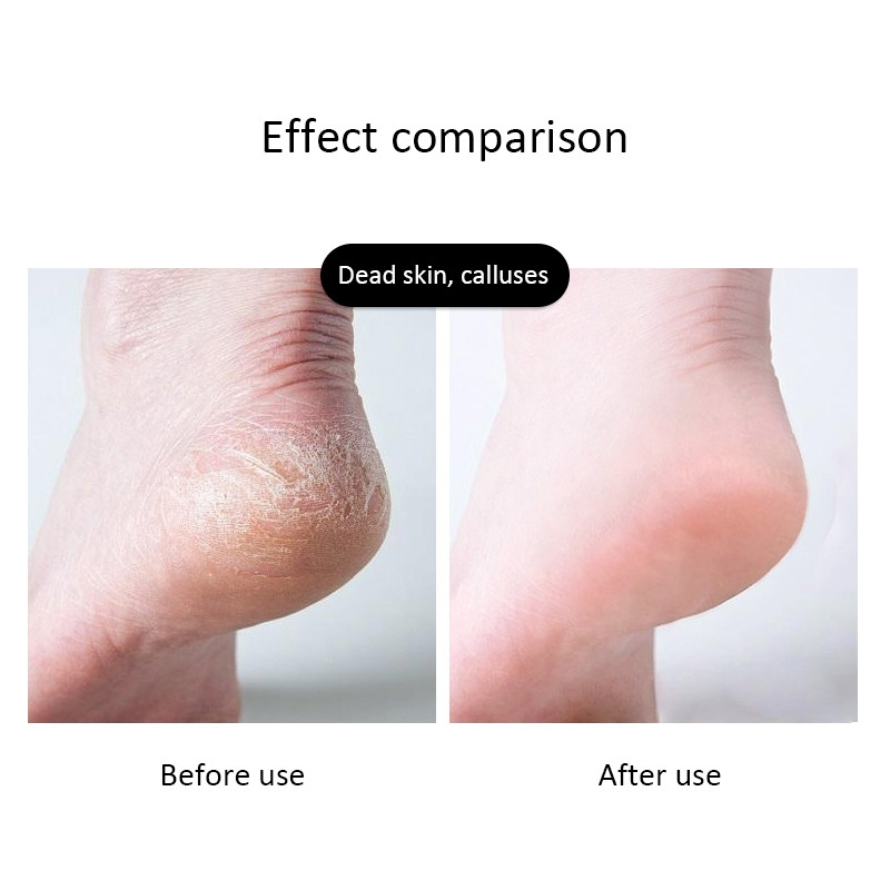 1PC Pilă pentru picioare pedichiură de uz casnic din oțel inoxidabil cu mâner din plastic pentru îndepărtarea calusurilor și a pielii moarte Instrument zilnic de îngrijire a picioarelor