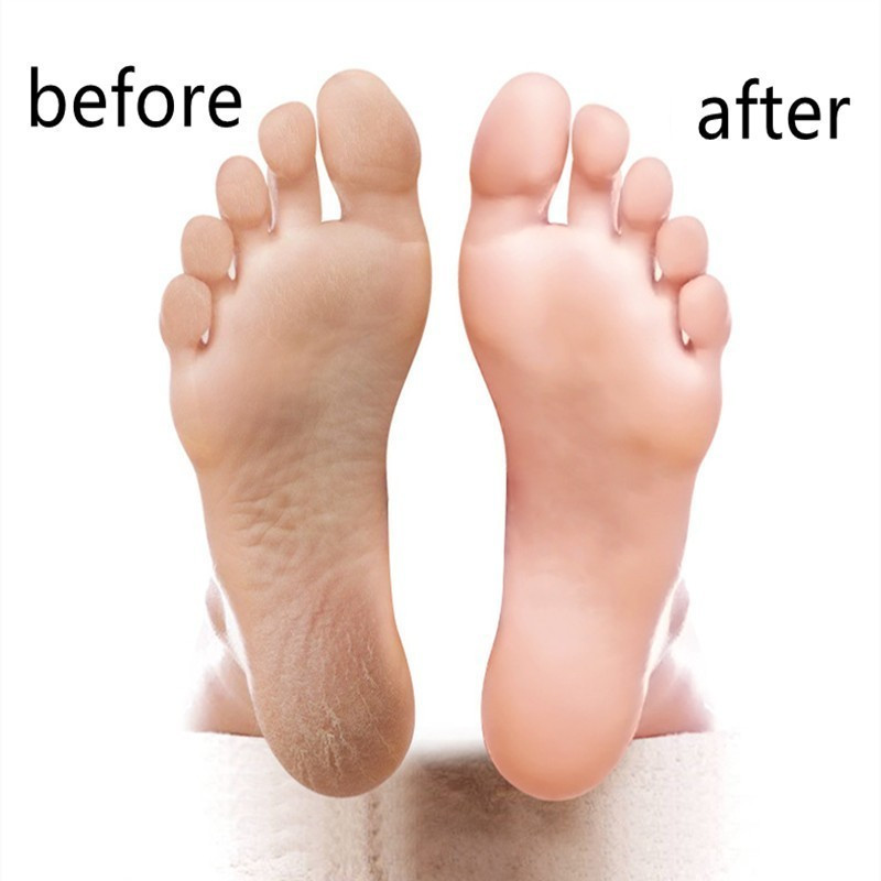 Profesionali nerūdijančio plieno pėdų rasp pėdų kulno dildė pėdoms nuospaudų valiklis stambios negyvos odos valiklis pėdų priežiūros priemonė