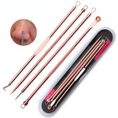 4 τμχ/σετ Επαγγελματικό προϊόν αφαίρεσης σπυριών μαύρων κηλίδων Beauty Skin Care Γυναικεία Σετ εργαλείων καθαρισμού προσώπου για αφαίρεση σπυριών