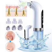 Εργαλεία καθαρισμού προσώπου με επαναφορτιζόμενο USB κύκλου νερού, ηλεκτρική σκούπα προσώπου, ηλεκτρικό σπυράκι αφαίρεσης μαύρου κεφαλιού