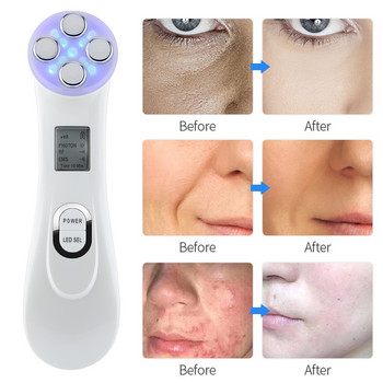 5в1 LED фотонна терапия Машина за повдигане на лицето Подмладяване на кожата против бръчки Радиочестота EMS Изтъняване на кожата Устройство за красота