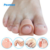 Pexmen 2/4/10Pcs Soft Gel Toe Separators Toe Spacers Bunion Corrector για επικάλυψη Hallux Valgus και Hammertoe Foot Care Tool