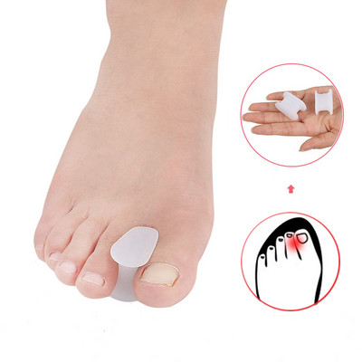 Pexmen 2/4/10 tk geelvarvaste eraldaja Hallux Valgus Bunion Corrector sirgendaja, pehme silikoonist varvaste kaitsja Spacer jalahooldusvahend