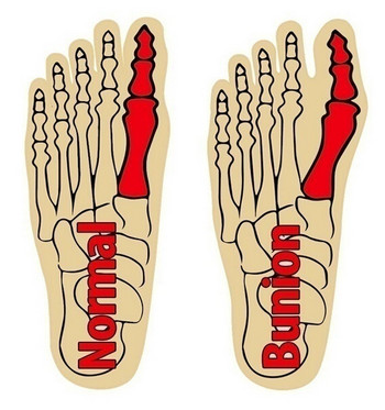 Разделител за пръстите на краката Чорапи Регулатор на палеца Изправяне Уред за ортопедични кости на краката Халукс Валгус Шина с ръкав Коректор за бунион