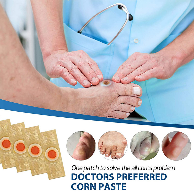 Jalgade maisi tapja kallused jalatallatüükad okkavalu leevendav kips jalahooldusvahend meditsiiniline kleebis varbakaitse