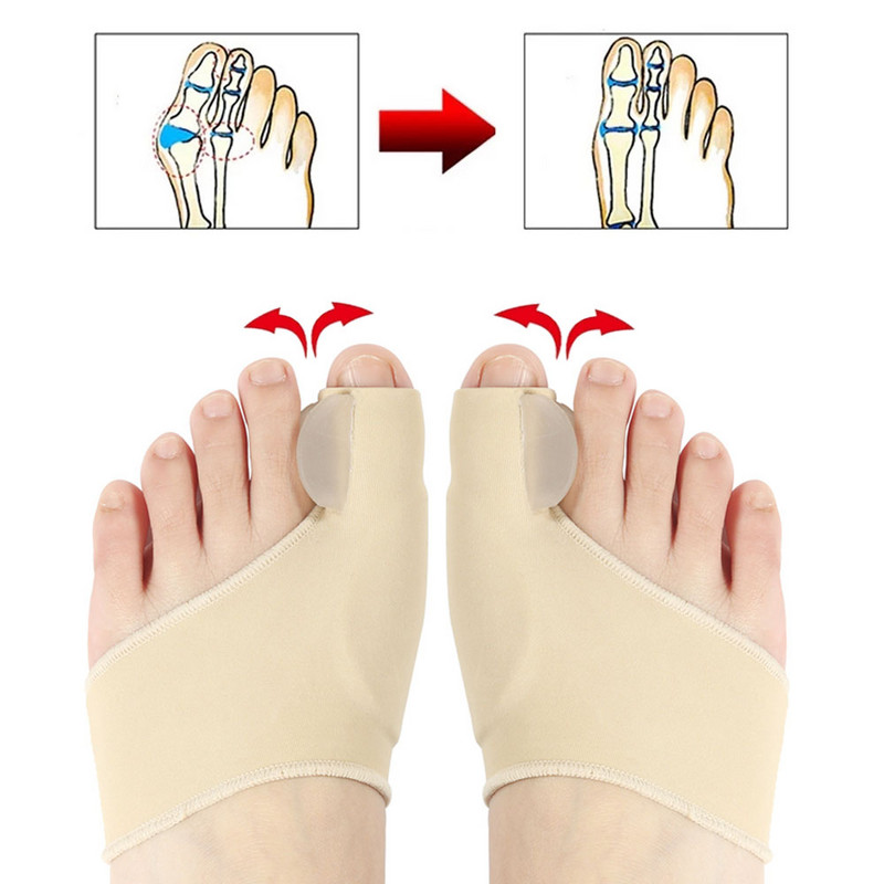 2tk=1paar varvaste eraldaja Hallux Valgus Bunion Corrector Orthotics Jalad Luu Pöidla Adjuster Korrektsioon Pediküür Soki Sirgendaja