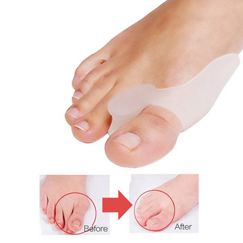 2 бр. = 1 двойка силиконови пръсти на краката Сепаратор Bunion Bone Ectropion Adjuster Външен уред Инструменти за грижа за краката Hallux Valgus Corrector