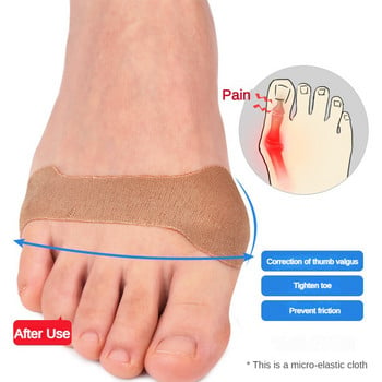 10PCS Ортодонтичен пластир Hallux Valgus Стикери за корекция на краката Hallux Valgus Correction Pad Thumb Orthotics Corrector Foot Care