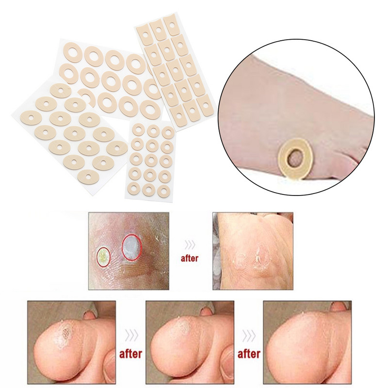 15 tk/leht Callus Padjad Kingad kannapadi vaht ümmargune varvas Jala maisi punnikaitsed padjad Meditsiiniline kips jalalaba maisi eemaldamine