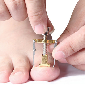 Щипка за изправяне Коректор за врастнали нокти Педикюр Инструменти за грижа за ноктите на краката Неръждаема стомана Педикюр Лечение Корекция на ониксис