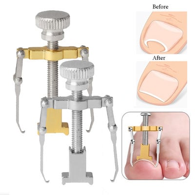 Κλιπ ισιώματος Ingrown Toenail Corrector Pedicure Εργαλεία περιποίησης νυχιών ποδιών από ανοξείδωτο ατσάλι Θεραπεία πεντικιούρ Onyxis Correction