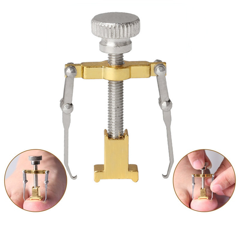 Kiegyenesítő klip Benőtt köröm korrekciója pedikűr lábkörömápoló eszközök rozsdamentes acél pedikűr kezelés Onyxis korrekció