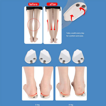 2PCS Корекция на стелки Вложки за обувки Подложки Ефективни O/X тип Крака Извити крака Коляно Valgum Изправяне за жени Мъже Здравеопазване