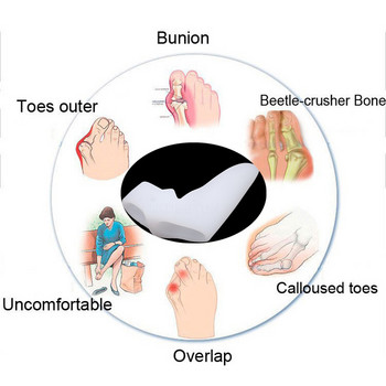 Черен бунион коректор Медицинско устройство Hallux Valgus Foot Care Разделител на пръстите на палеца Valgus Protector Шина за корекция на краката Инструмент