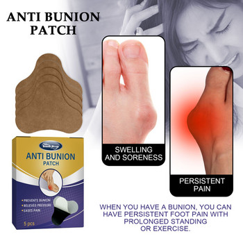 Επίθεμα θεραπείας ουρικής αρθρίτιδας South Moon Pack Bunion Toe Bunion Ανακούφιση πόνου από γύψινη άρθρωση οστών ποδιών Αυτοκόλλητα κατά του αντίχειρα