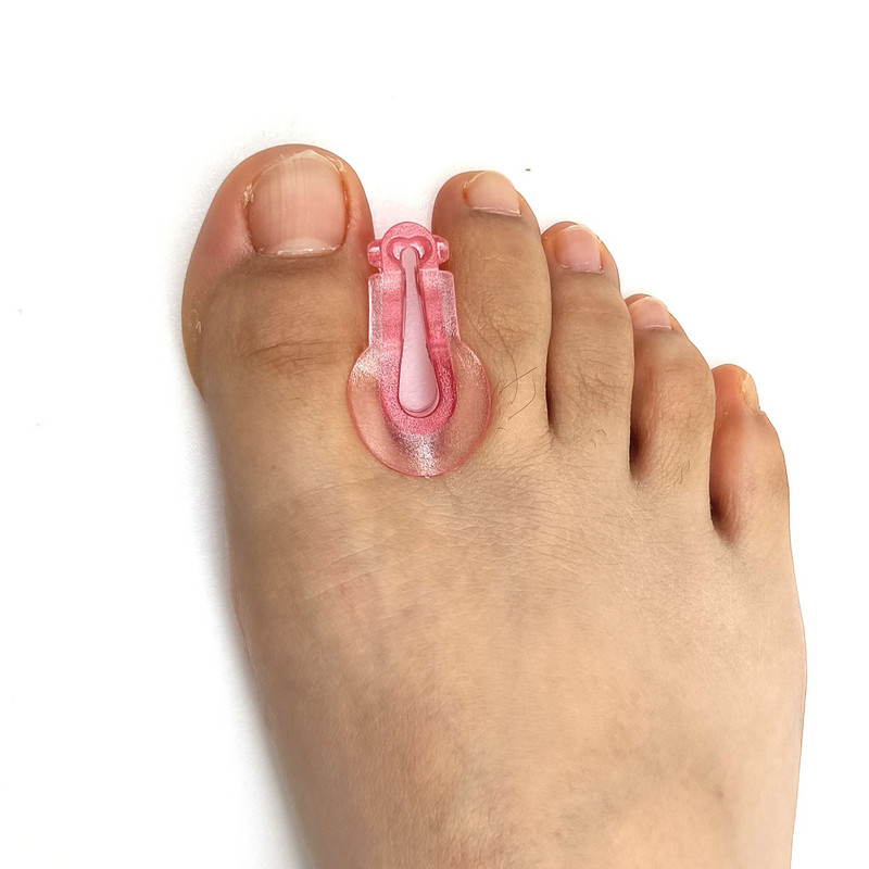 2 TK varvaste eraldaja joondusseade padja varbapadja kaitse silikoonist pöidla Valgus korrektor jalalaba sõrm kõverdunud varvaste jaoks