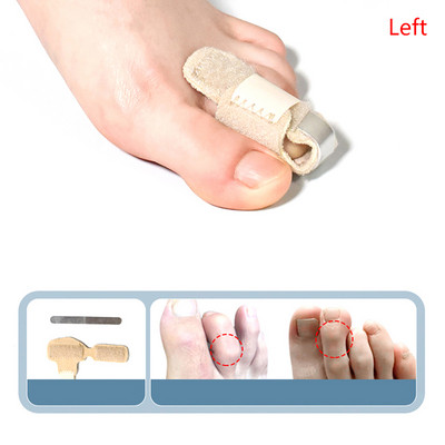 Sõrmetugi traks päästik Sõrme lahas dislokatsiooni tugi pöidla painutamise abil vööriliigese immobiliseerimine luumurru valu leevendamine