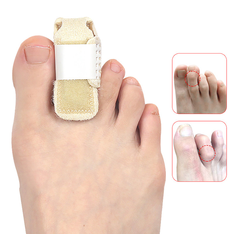 Sõrmetugi traks päästik Sõrme lahas dislokatsiooni tugi pöidla painutamise abil vööriliigese immobiliseerimine luumurru valu leevendamine