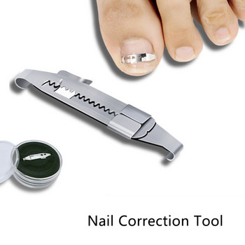 Инструмент за корекция на врастнали нокти Коректори за изправяне на ноктите на краката Инструмент за лепенки Щипка за изправяне Инструмент за педикюр