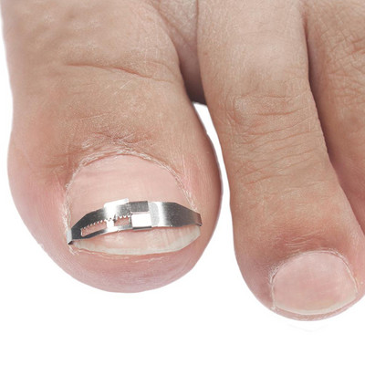Instrument de corectare a unghiilor încarnate pentru degetele de la picior Instrument de corectare pentru îndreptarea unghiilor de la picior