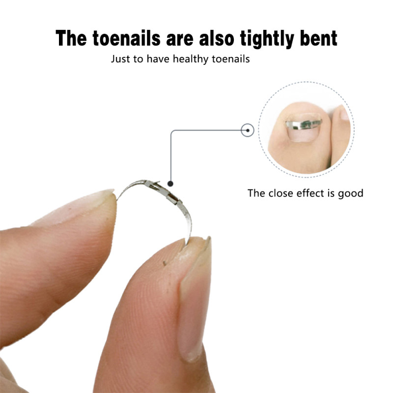 Alat za ispravljanje uraslog nokta Korektori za ispravljanje noktiju Alat za flaster Stezaljka za ravnanje Steznica Alat za pedikuru