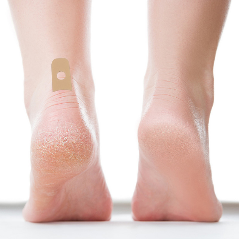 45 tk isekleepuvad kallusepadjad u-kujulised kallusepadjad, kallused, kallus hobuseraua Jalahoolduspadjad jalanõudele hõõrdumisel tekkivad kallused